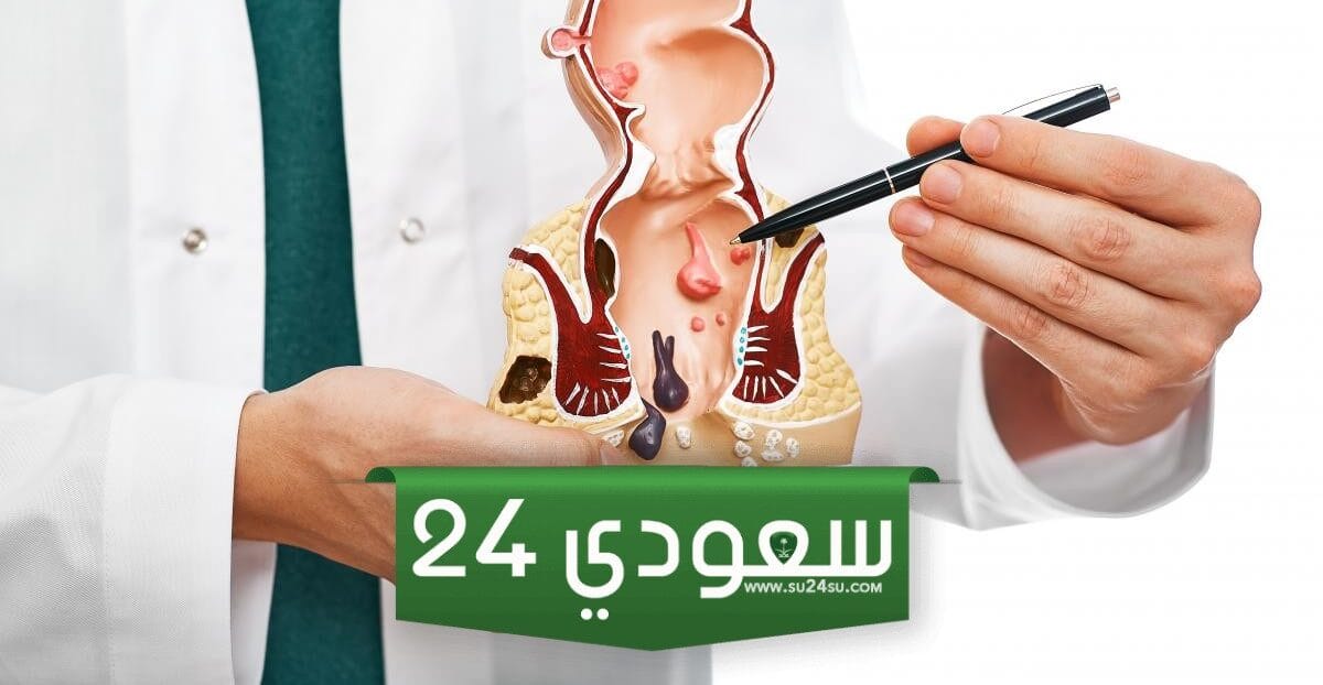 أفضل دكتور بواسير في مستشفى الحبيب