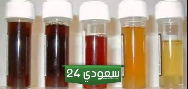 اسباب رغوة في البول