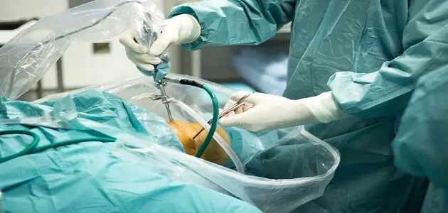 تكلفة عملية قطع غضروف الركبة