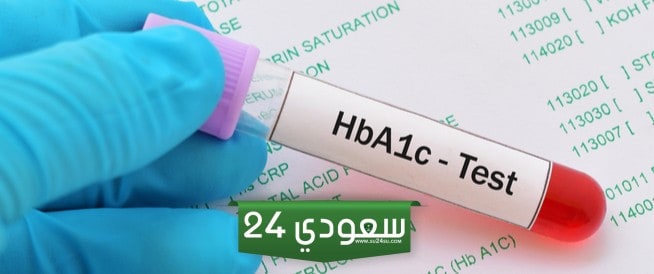 جدول السكر التراكمي حسب العمر