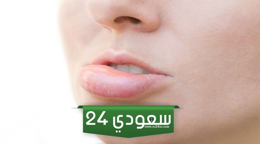 علاج تورم الشفاه بعد البنج
