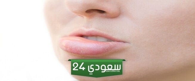 علاج تورم الشفاه بعد البنج