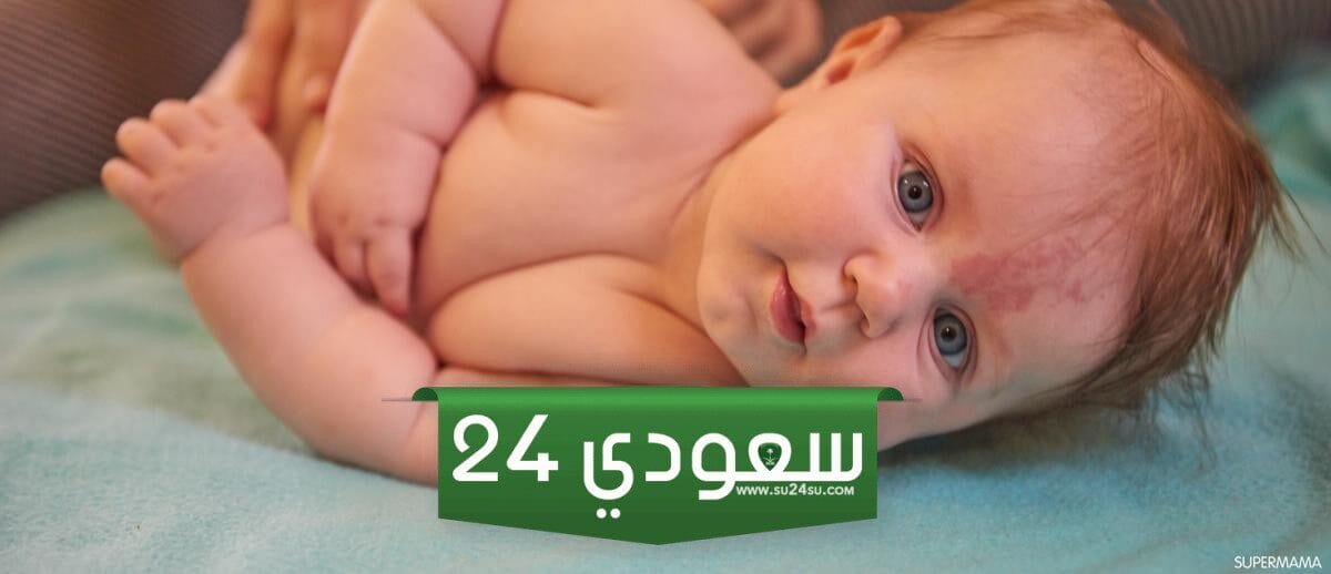 مرهم لعلاج الكدمات حول العين للأطفال
