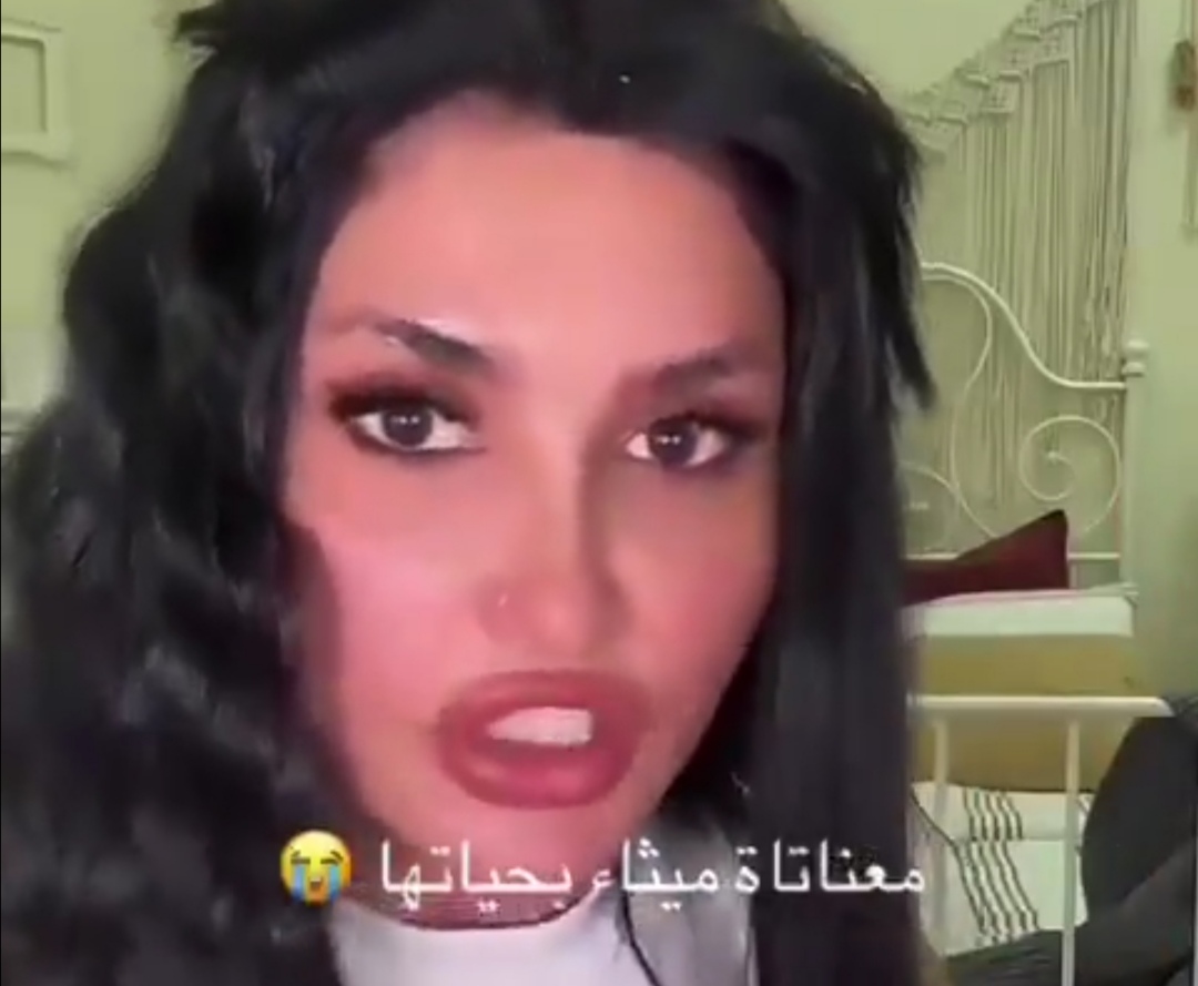 شوه وجهها.. شاهد تيك توكر لبنانية شهيرة تكشف تفاصيل تعرضها للضرب المبرح على يد زوجها