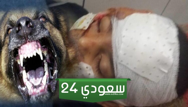 كلب مسعور يهاجم 12 طفلا وسيدة بالغربية