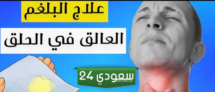 كيف اتخلص من البلغم بطرائق بسيطة في البيت