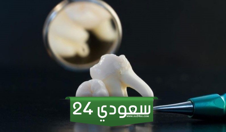 تفسير حلم الضرس المثقوب