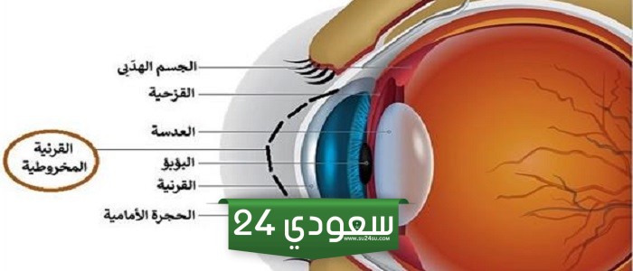 القرنية المخروطية أسبابها وطرق علاجها وعلاقتها بعملية الليزك