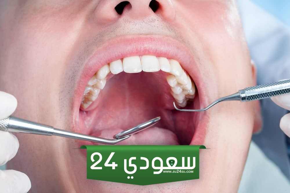 رؤية تسوس الأسنان وتساقطها