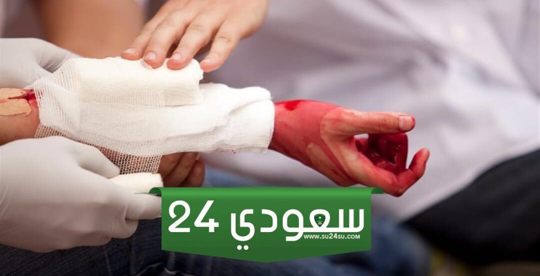 مرض الهيموفيليا أعراضه ونتائجه وطريقة الوقاية منه…وهل هو خطير؟