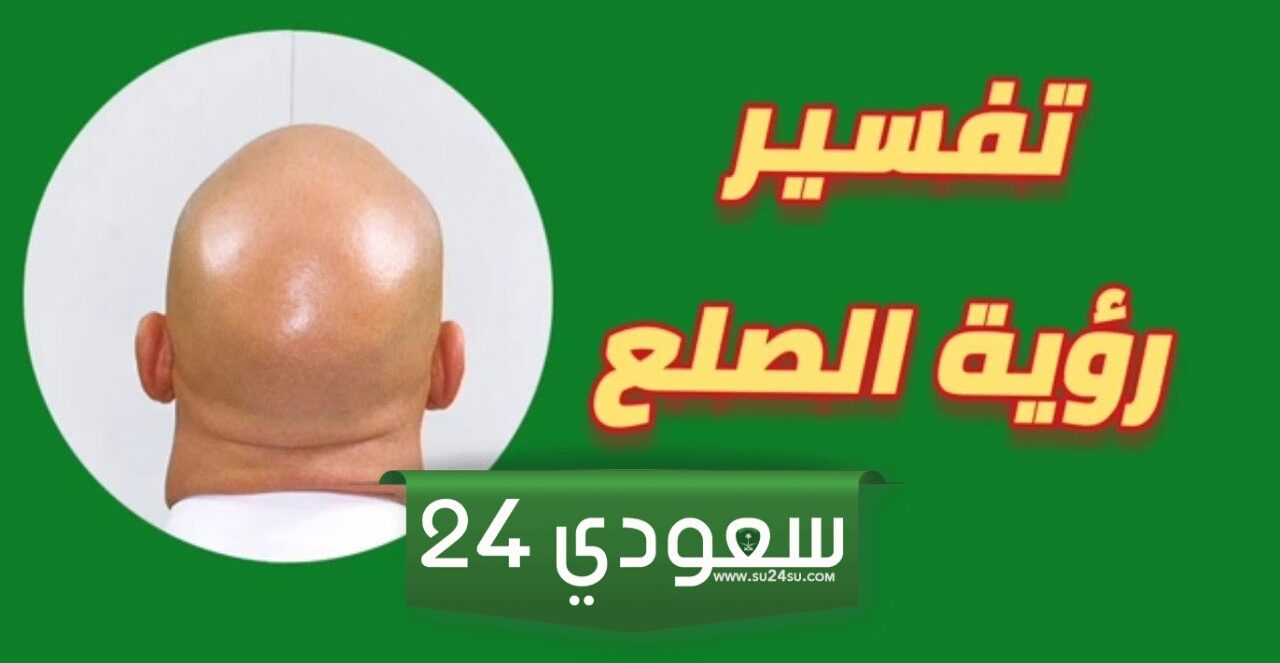 تفسير رؤية الصلع الجزئي والكلي في المنام