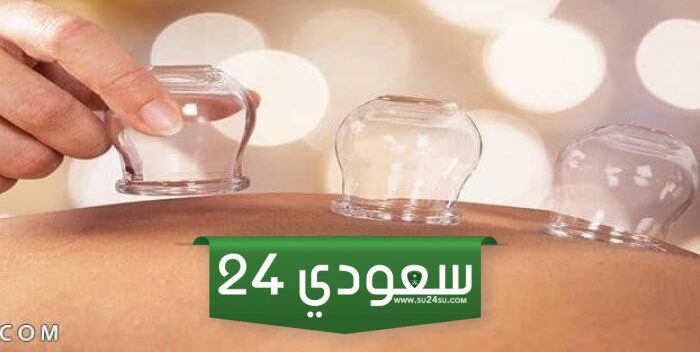 تجربتي مع الحجامة والزواج والحمل