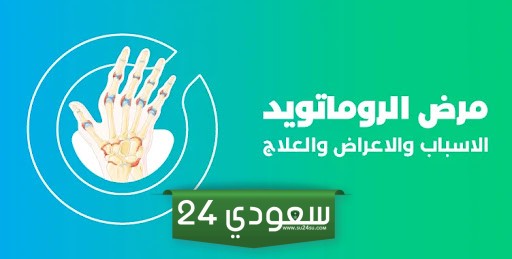 تجربتي مع مرض الروماتويد وأعراضه وطرق علاجه