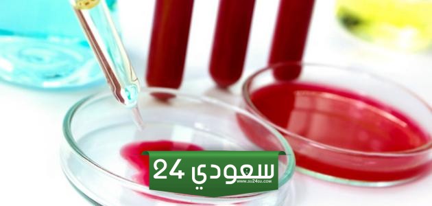 كيف اعرف نتيجة فحص الزواج في السعودية 1446 بالخطوات التفصيلية