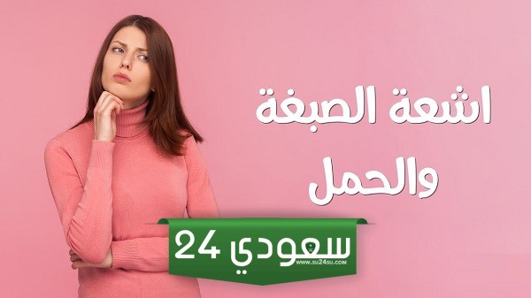 تجربتي مع أعراض الحمل بعد اشعة الصبغة مباشره ودلالتها "نوع الجنين"