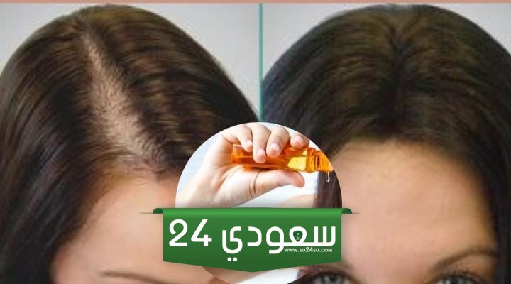 وصفة سحرية لتحسين صحة الشعر